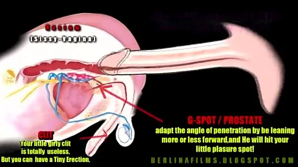 Nuovo anatomia transtubo di clip