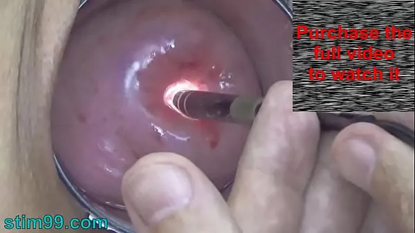 Fresh Endoscopic Camera in Cervix watch inside my Womb and Vagina. Inspection testing exam of wife by extreme doctor gynecologist clips Tube